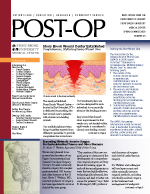 Adobe Acrobat Reader is needed to view POST-OP.