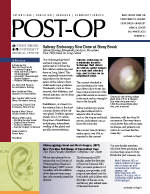 Adobe Acrobat Reader is needed to view POST-OP.