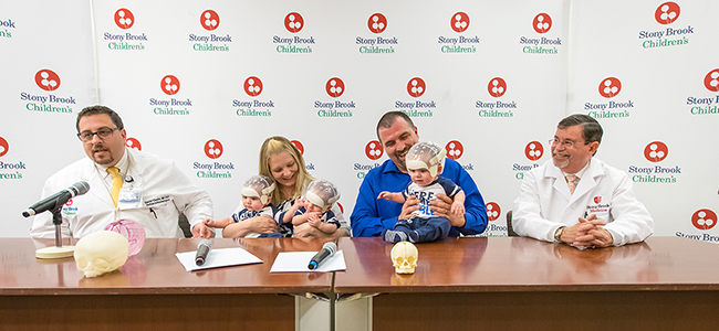 Triplets Undergo First-Ever Surgery for Rare Skull Condition
