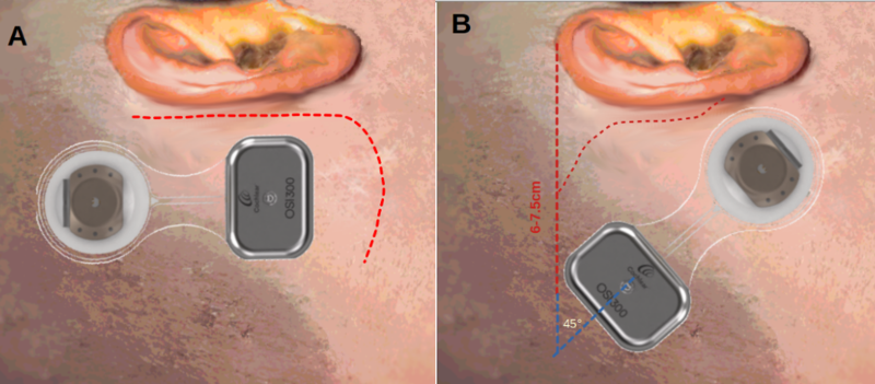 Winter 2026 ENT Newsletter Top Image