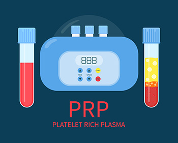 Plasma Rich Plakèt