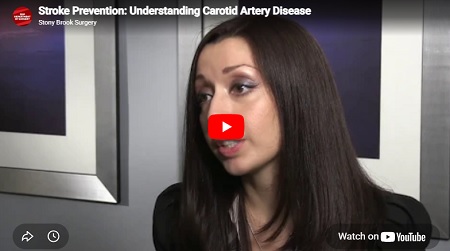 Angela A. Kokkosis, MD - Stroke Prevention: Understanding Carotid Artery Disease - Video CoverS Slide