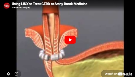 SB Using LINX Slidecover