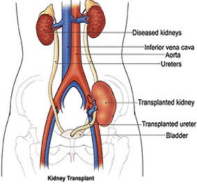 Kidney