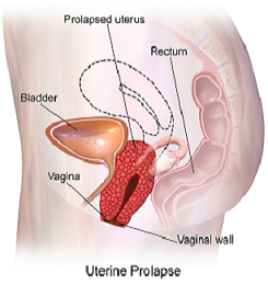 operasyon reconstructive